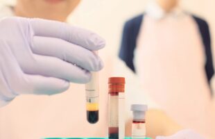 Urussanga credencia novos laboratórios e reforça o atendimento em exames de saúde
