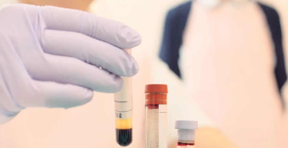 Urussanga credencia novos laboratórios e reforça o atendimento em exames de saúde