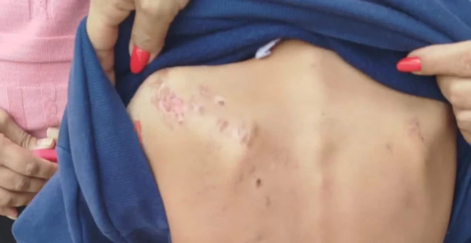 Menino de 7 anos com TEA é agredido pelo padrasto em Morro da Fumaça