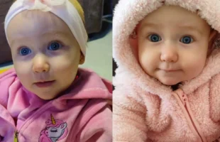 Bebê de 10 meses morre em Chapecó e tem órgãos doados pela família