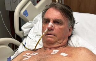 Bolsonaro inicia fisioterapia após cirurgia, sem previsão de alta