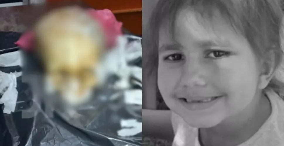 Furto de crânio de criança em cemitério causa comoção e vira caso na Justiça