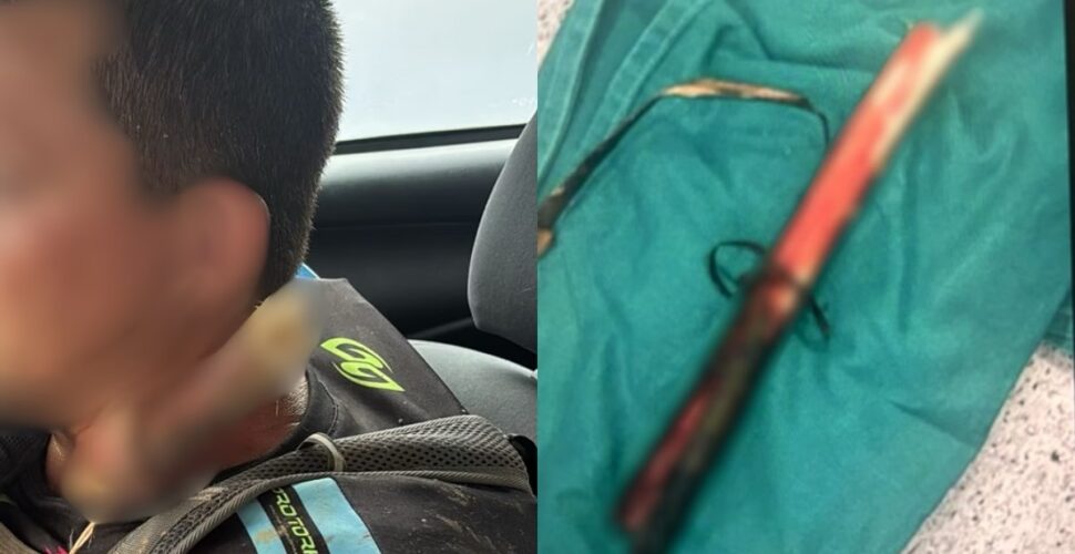 Galho atravessa pescoço de trilheiro e homem sobrevive em SC