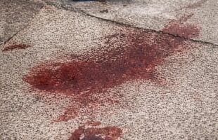 Homem é esfaqueado sete vezes em via pública em Içara