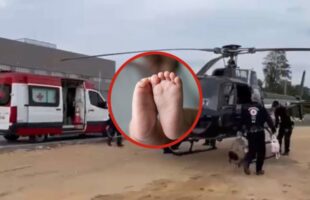Bebê de 10 meses sofre fratura no crânio após cair da cama em Braço do Norte