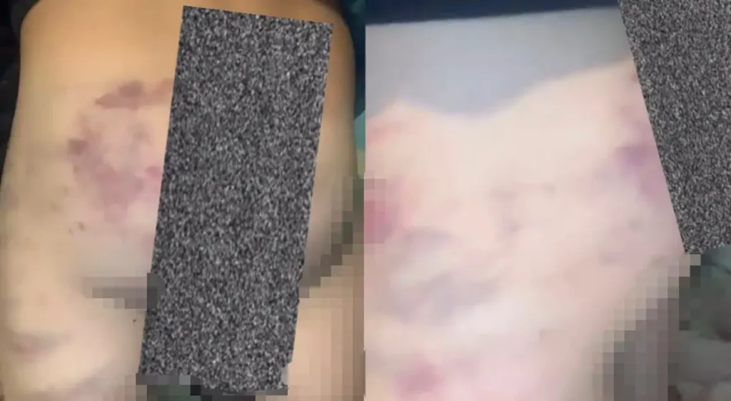 Menino de 5 anos é vítima de agressão e pai é investigado por maus-tratos em Sangão