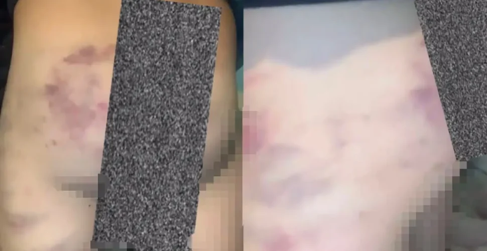Menino de 5 anos é vítima de agressão e pai é investigado por maus-tratos em Sangão